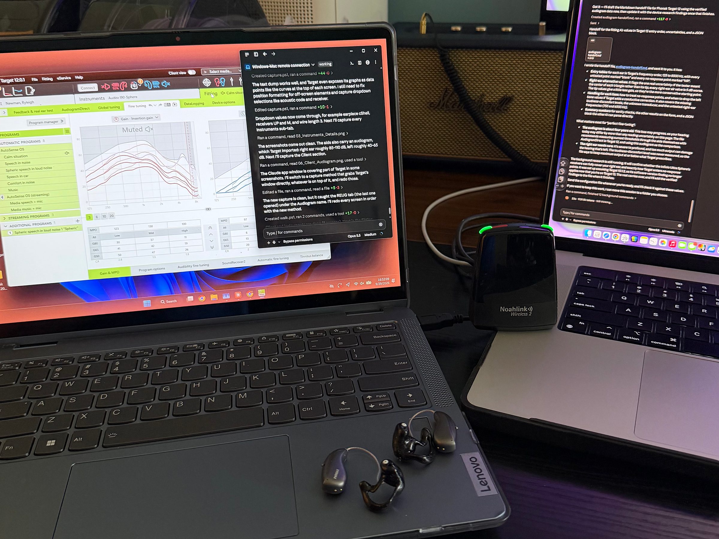 A Windows laptop running Phonak Target beside a MacBook running Claude, with a Noahlink Wireless 2 dongle and two Phonak Audeo Sphere hearing aids.