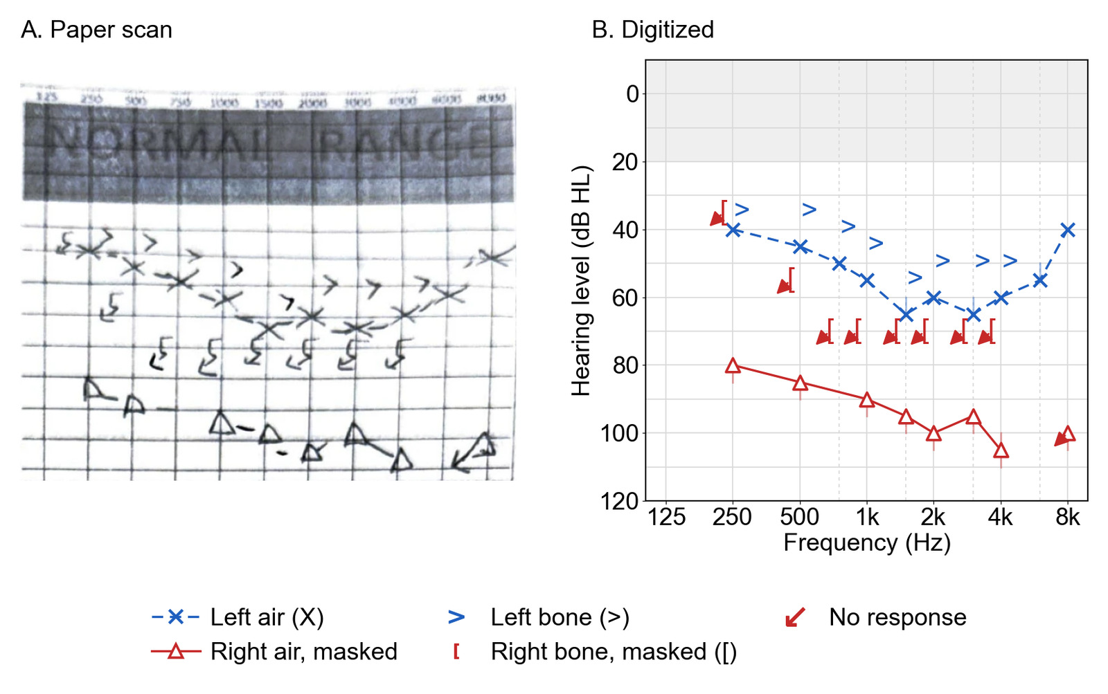 Side-by-side comparison of the scanned audiogram graph and a digitized version on a log frequency axis, with the left ear as blue X symbols and the right ear as red triangles.