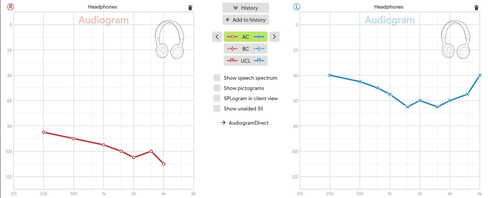 Phonak Target's Client audiogram screen with two graphs labeled Headphones. The right ear, in red circles, runs from 85 dB at 250 Hz down to 110 dB at 4 kHz. The left ear, in blue X symbols, runs from 40 dB at 250 Hz to 65 dB around 1.5 and 3 kHz and back up to 40 dB at 8 kHz. Between them are AC, BC and UCL buttons and display options.